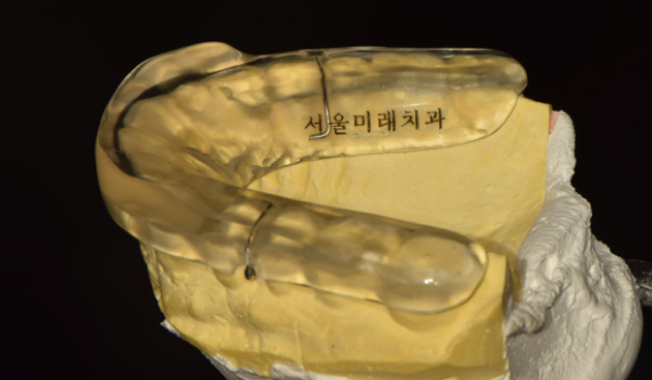 가이드 블록
